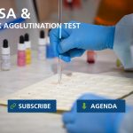 Elisa-and_latex_agglutination_test